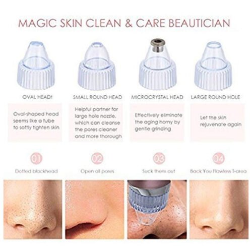 lg_RHBOvj8l1gm8uF2FnVe0uo03OJtraAesmxXME89L Kemei KM-8050 5 In 1 Electric Blackhead Remover