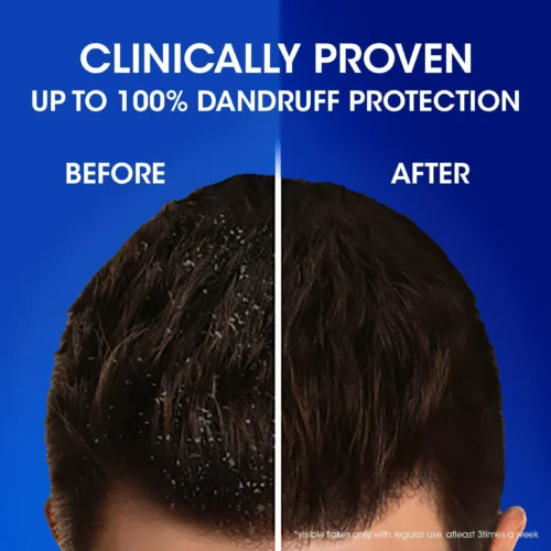 Head & Shoulders Anti-Hairfall Shampoo