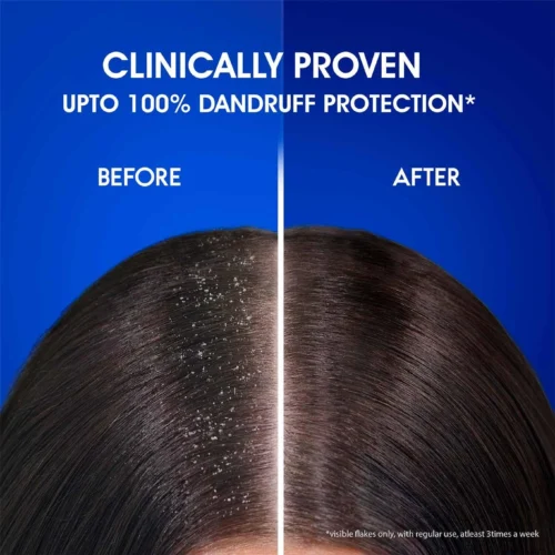 Head & Shoulders Anti-Hairfall Shampoo