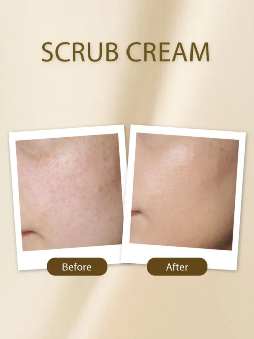 Soft Touch Moisturizing Scrub Cream - 75ml