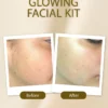 Soft Touch Whitening Facial Trial Kit