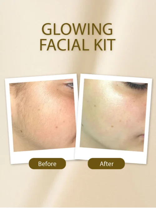 Soft Touch Whitening Facial Trial Kit