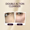 Soft Touch Double Action Cleanser - 75ml