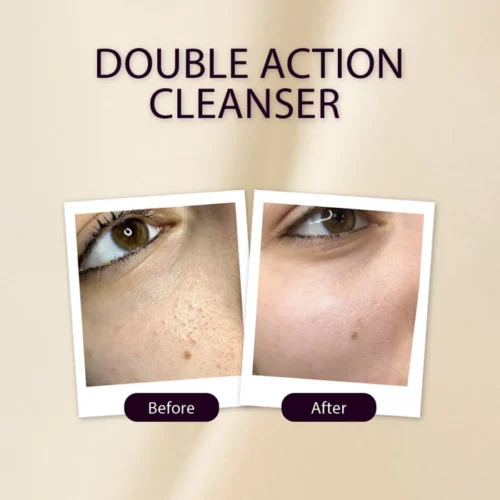 Soft Touch Double Action Cleanser - 75ml