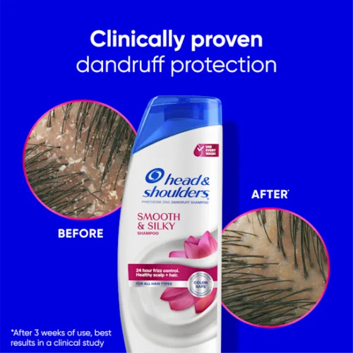 Head & Shoulders Smooth & Silky Dandruff Shampoo